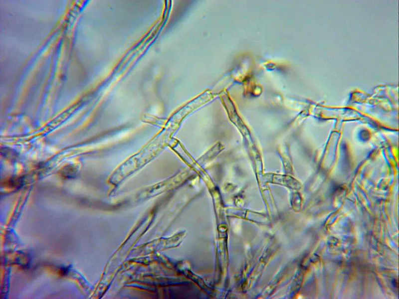 Byssoporia terrestris 10 - Hifas agua 2